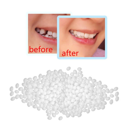 15g/25g Temporary Tooth Repair Kit Teeth And Gaps FalseTeeth Solid Glue Denture Adhesive Teeth Whitening Tooth Beauty Tool #T