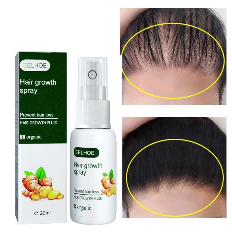 Fast Hair Growth Spray Serum Ginger Anti Hair Loss Treatment Product Prevent Thinning Dry Frizzy Repair Beauty Hair Care Essence