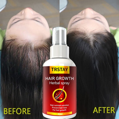 Hair Growth Serum Spray Fast Hair Growth Liquid Treatment Scalp Hair Follicle Anti Hair Loss Natural Beauty Health Hair Care