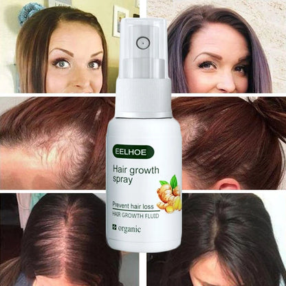 Fast Hair Growth Spray Serum Ginger Anti Hair Loss Treatment Product Prevent Thinning Dry Frizzy Repair Beauty Hair Care Essence